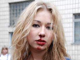 В Интернете появилось видео зверского избиения экс-солистки «Ранеток»