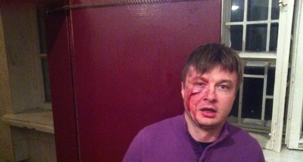 В Киеве возле РОВД избили нардепа от ВО 