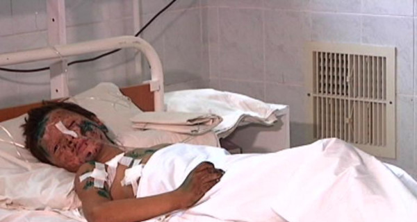 Раненого 9-летнего Сережу из Володарского готовят к операции