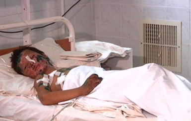 Раненого 9-летнего Сережу из Володарского готовят к операции