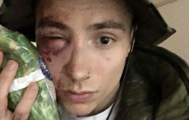 В Киеве избили участника группы Quest Pistols Show