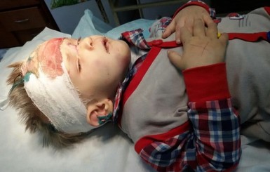 В Одессе собирают помощь для избитого потерявшегося малыша