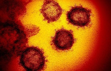 В Италии от коронавируса умер третий человек