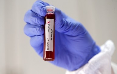 Что такое ИФА-тесты на коронавирус и будут ли они обязательными для всех