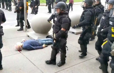 На протестах в США полицейские толкнули 75-летнего мужчину – он попал в больницу