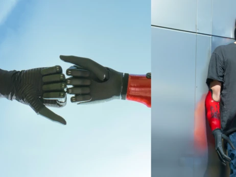 Факт. Двое военных получили бионические руки Esper Bionics от «Фундации Течия»