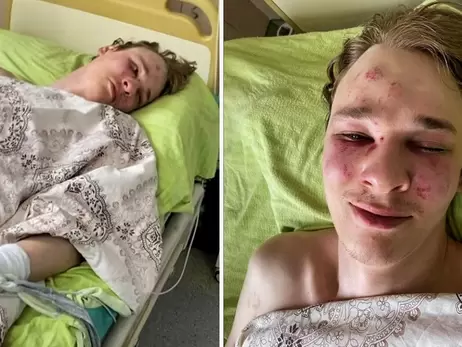 У Закарпатському обласному ТЦК спростували побиття хлопця, який здійснив спробу суїциду