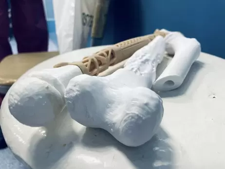 Вчена з КПІ друкує кістки на 3D-принтері: довжина імплантів сягає 40 сантиметрів